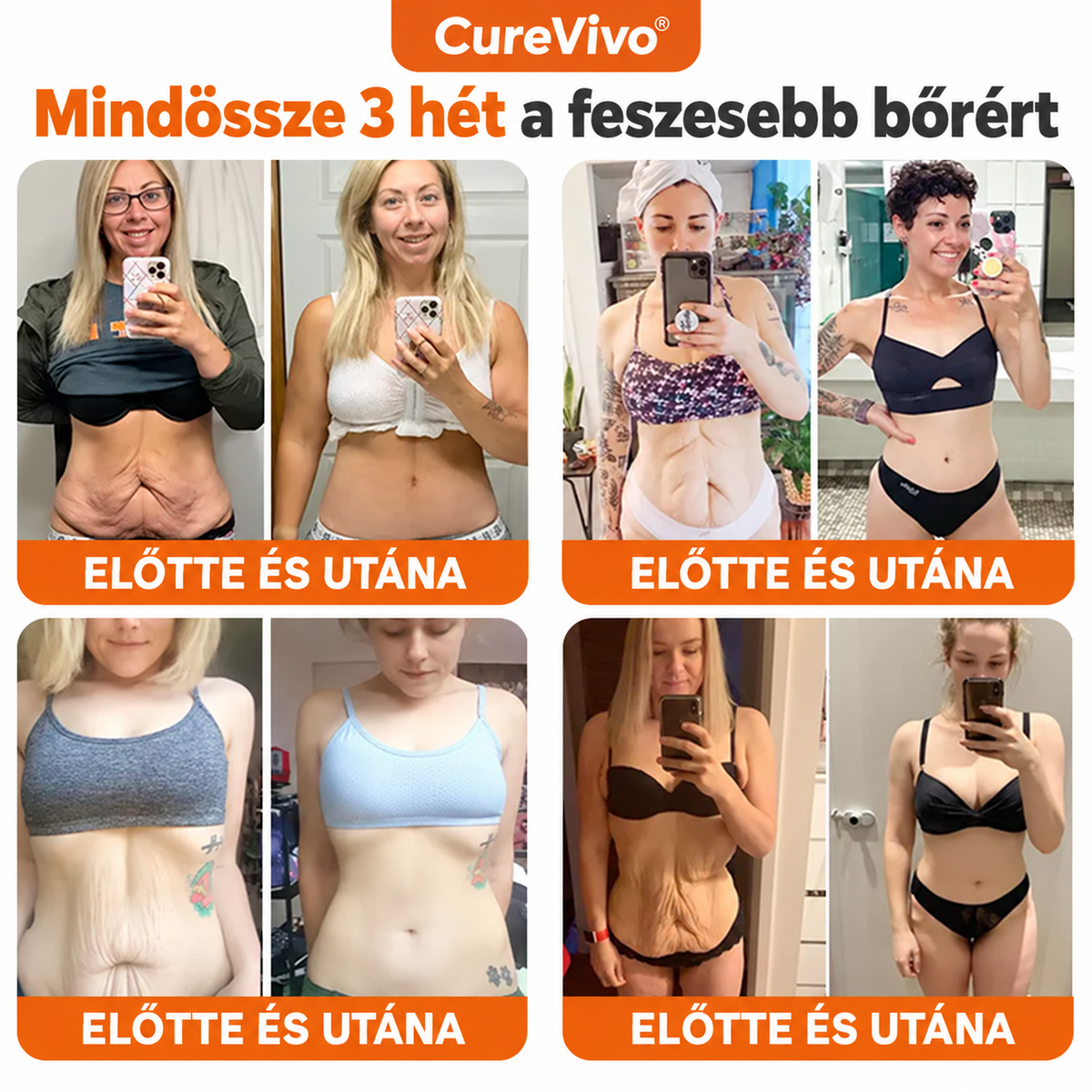 🔥Hivatalos Márkabolt 丨 CureVivo® Méhméreg Pro Komplex Krém — Bőrfeszesítés minden bőrtípusra