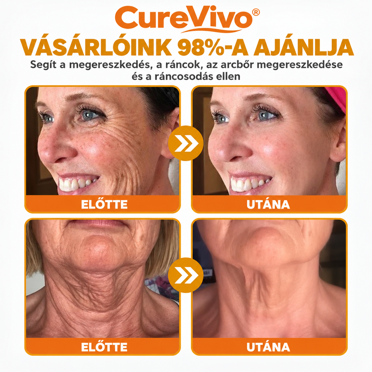 🔥Hivatalos Márkabolt 丨 CureVivo® Méhméreg Pro Komplex Krém — Bőrfeszesítés minden bőrtípusra