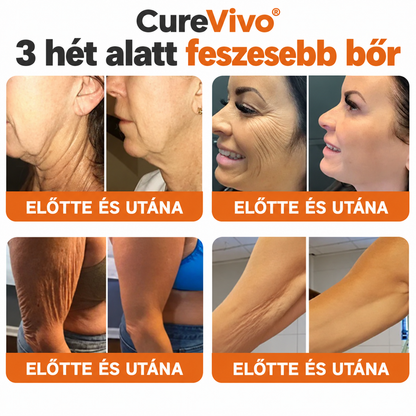 🔥Hivatalos Márkabolt 丨 CureVivo® Méhméreg Pro Komplex Krém — Bőrfeszesítés minden bőrtípusra